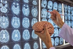 Top neurosurgeon in India