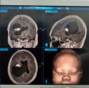 Neurosurgical Care