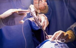 Brain and spine surgery in India