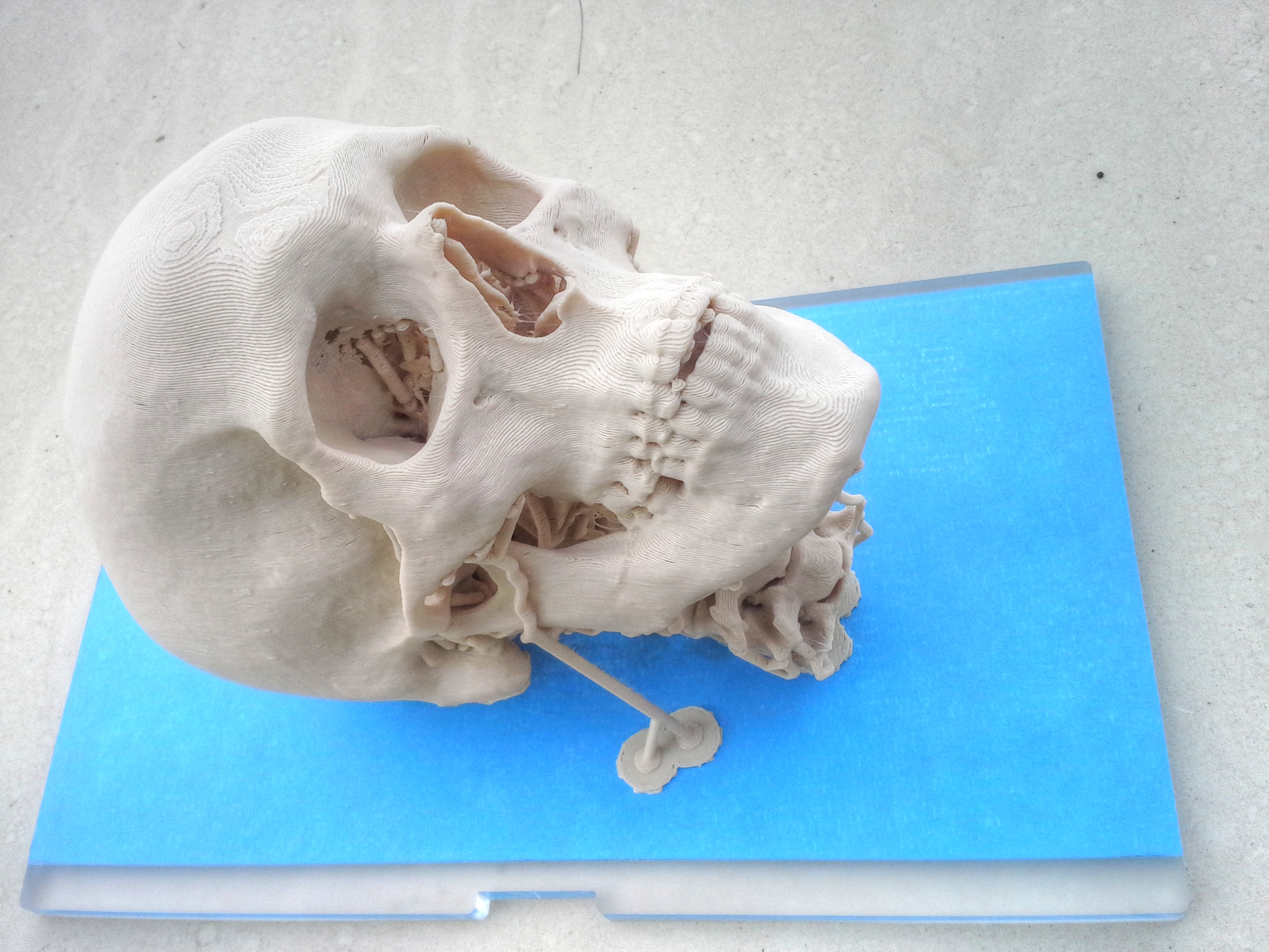 Craniosynostosis Treatment: Surgery, Timing & Recovery