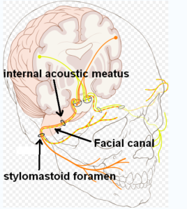 Facial nerve palsy treatment target on facial nerve anatomy