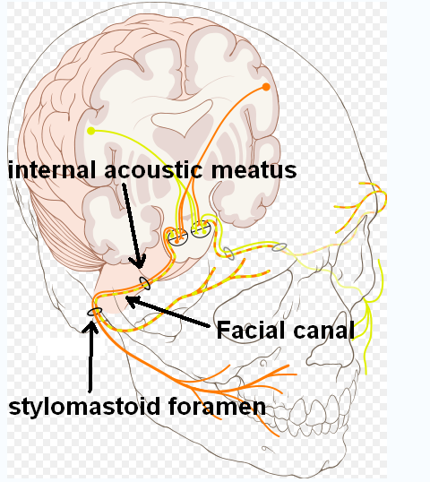 Facial nerve palsy treatment target on facial nerve anatomy